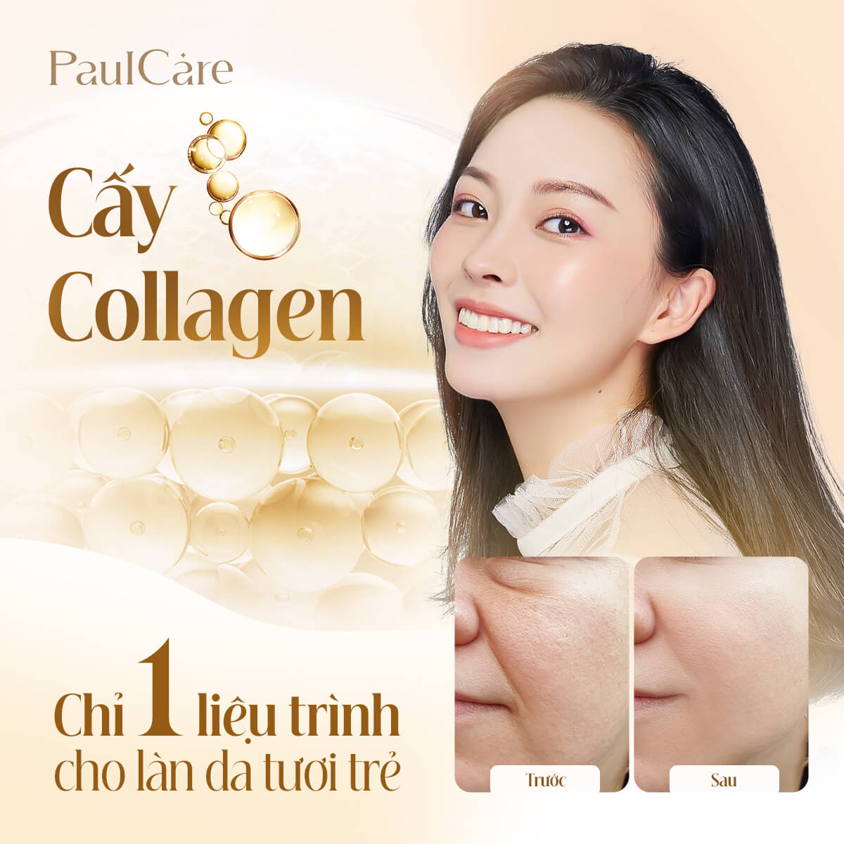 Cay_collagen_tuoi_tham_my_vien_paulcare