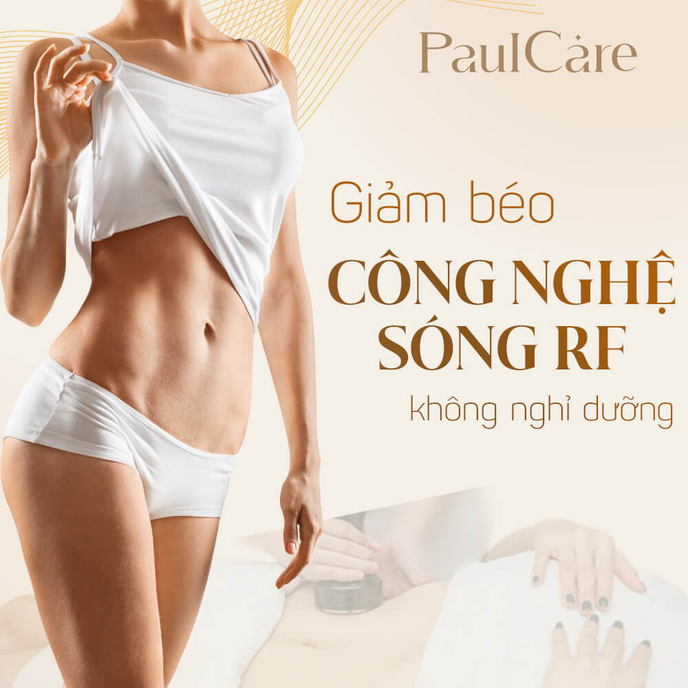 giam-beo-cong-nghe-rf-tham-my-vien-paulcare