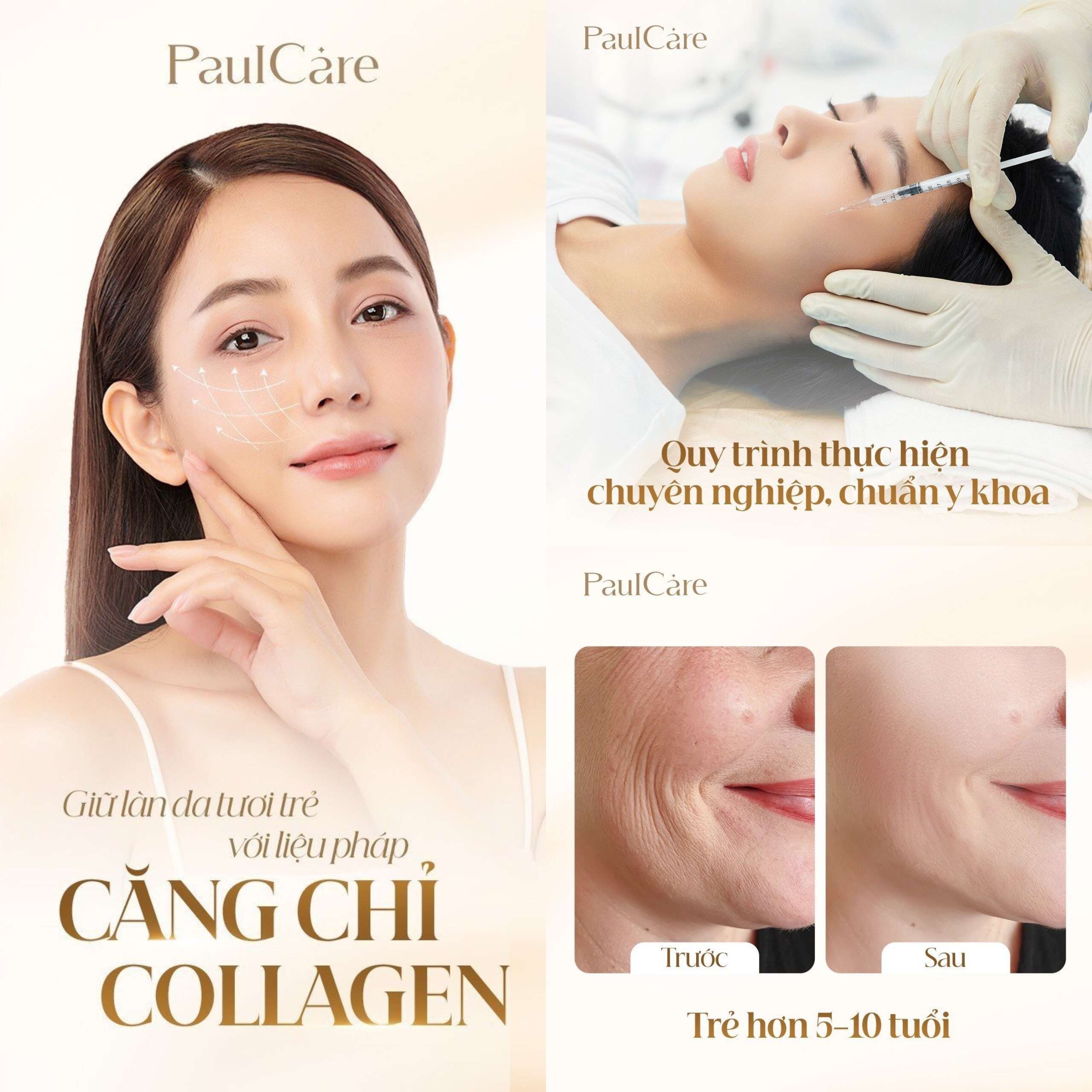 cang_chi_collagen_paulcare