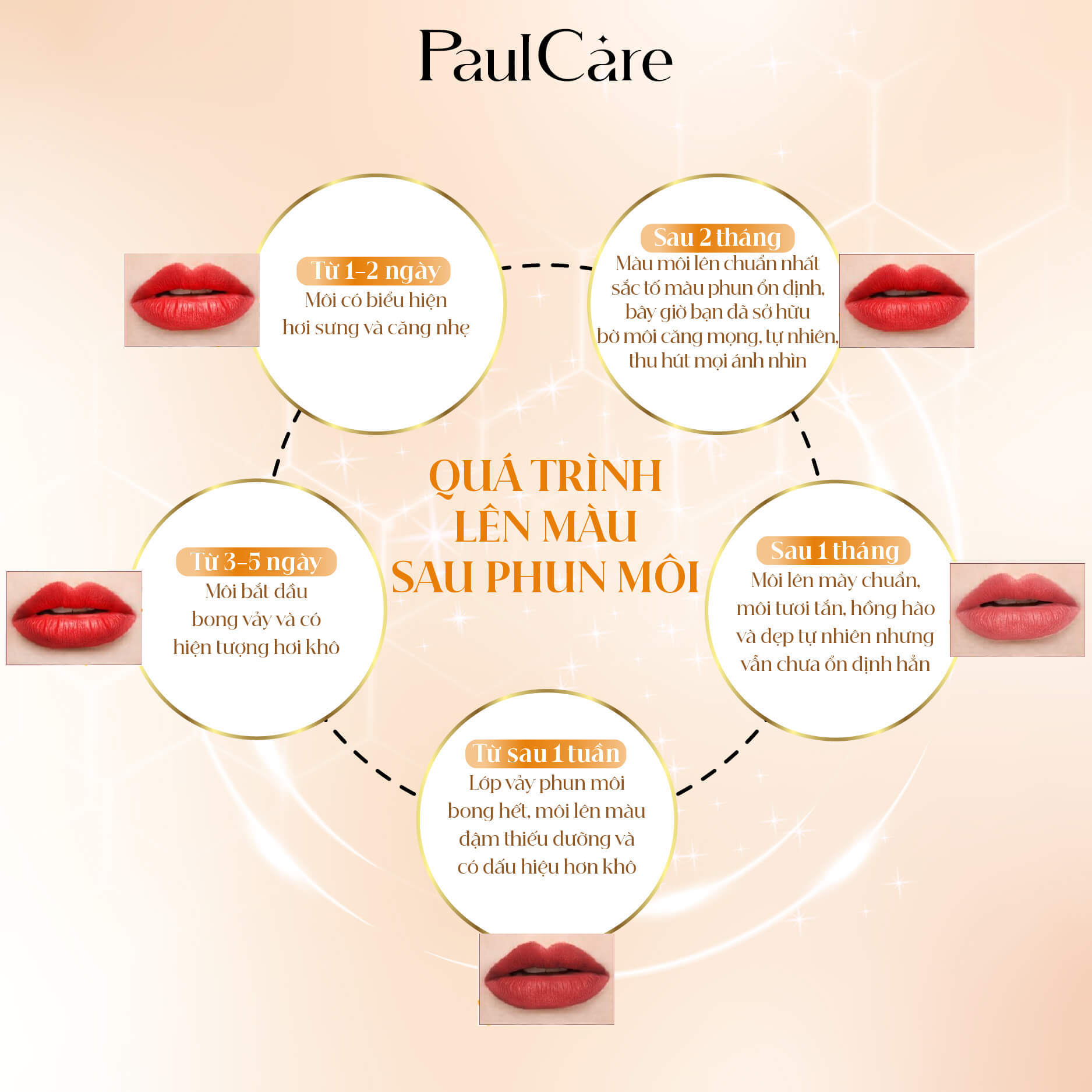 Quy_trinh_phuc_hoi_moi_phun_tham_my_vien_paulcare