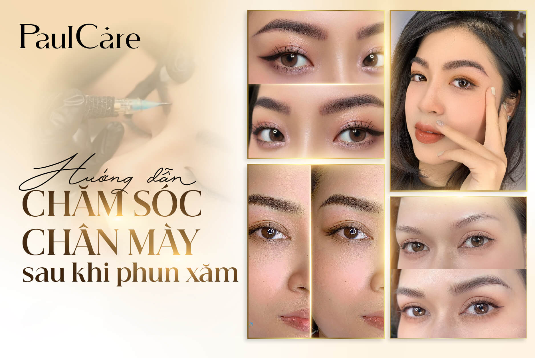 Cham_soc_sau_phun_may_tham_my_vien_PaulCare
